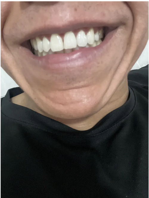 Cliente oismile